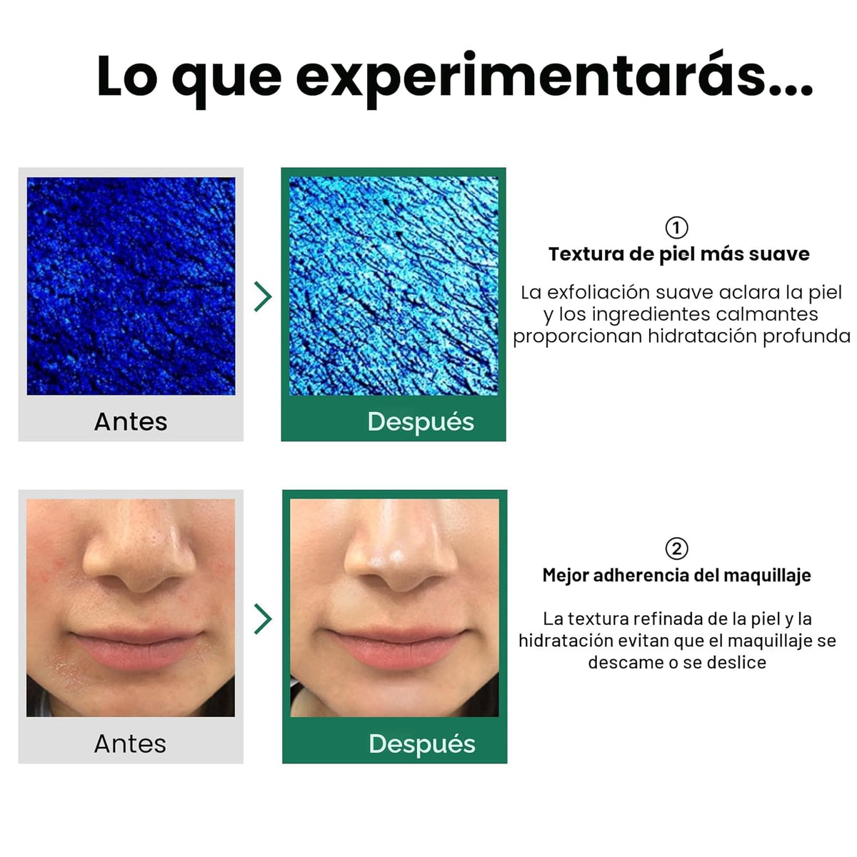 [SOMEBYMI] AHA.BHA.PHA Tóner Milagroso de 30 Días 150ml