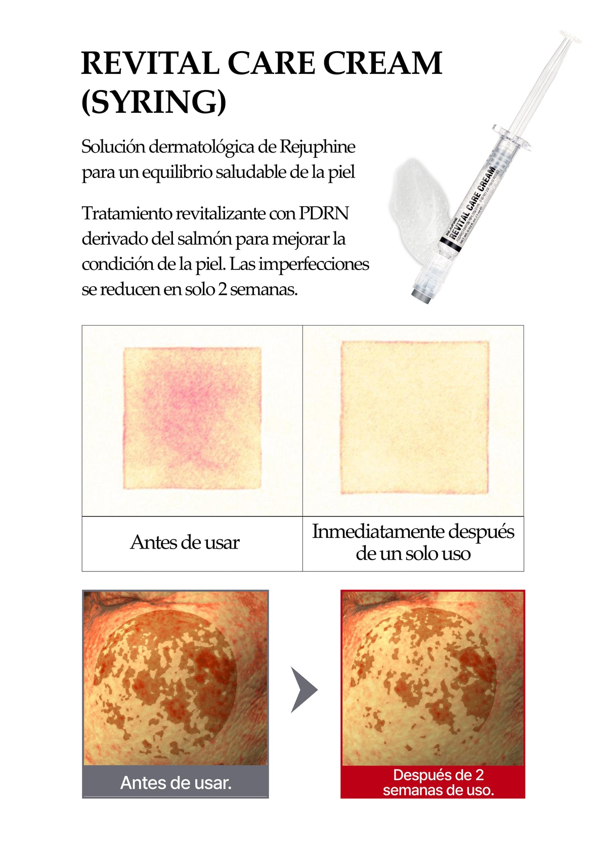 [Rejufine] Rejufine Revital Care Crema (Syringe) 1ml 1 EA